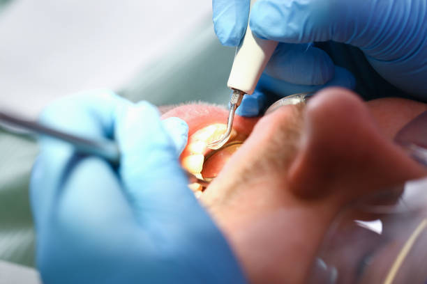 Best Mobile Emergency Dentist in Royalton, IL