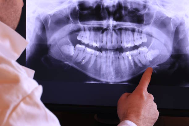 Best Emergency Root Canal Treatment in Royalton, IL
