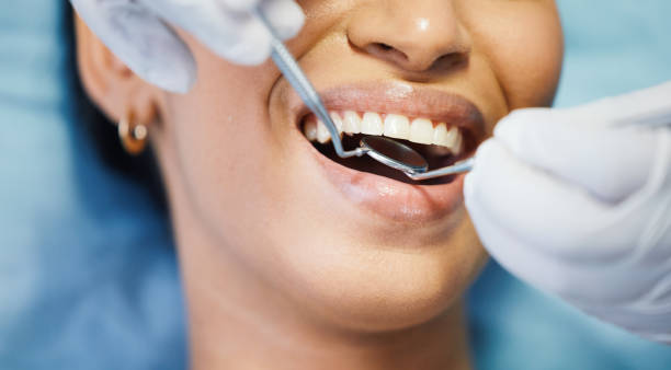 Best Emergency Root Canal Treatment in Royalton, IL